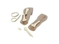 310_Имитатор переломов для рентгенологии 1