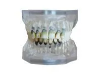 310_МУ0319_Денто-модель_ЧВН-28П_1