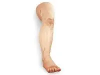 310_1005683 Тренажер для швов, нога 1