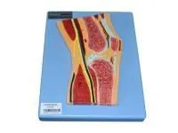 310_A11206_Модель коленного сустава в разрезе (на подставке) 2