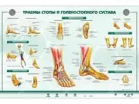 310_Стенд_Травмы_стопы_голеностопного_сустава