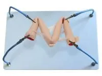 310_МУ0398_Пособие_спайки_тонкой_кишки