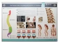 310_МУ0074_Стенд_патологии_позвоночного_столба