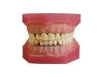 310_МУ0361_Денто-модель_ЧВН-32П_1