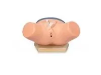 P17F Тренажер для демонстрации навыков катетеризации уретры у женщин