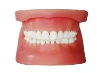 310_Денто-модель_челюстей_для_удаления