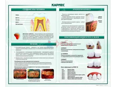 310_МУ0255_Стенд_Кариес