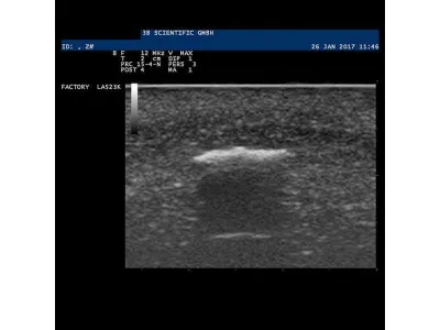 1019636 Модель инородного тела SONOtrain™ для УЗИ