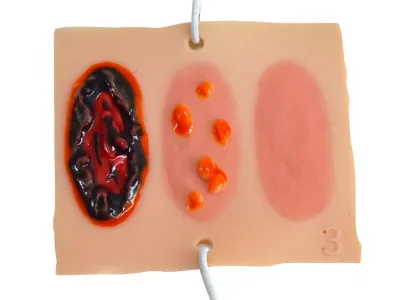 М1025 Набор имитаторов ран