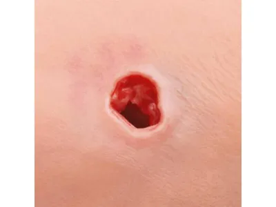 1022652 Рука-тренажер для обучения остановки кровотечения