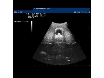 1019637 Модель вен SONOtrain™ для УЗИ