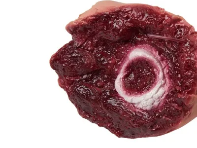 Медицинский расходник ампутированная нога к арт. 1005711_3