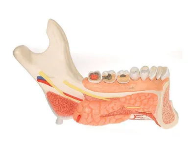 Усовершенствованная модель половины нижней челюсти с 8 больными зубами, 19 частей 3B Smart Anatomy_1