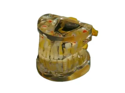 Модель челюстей с патологиями