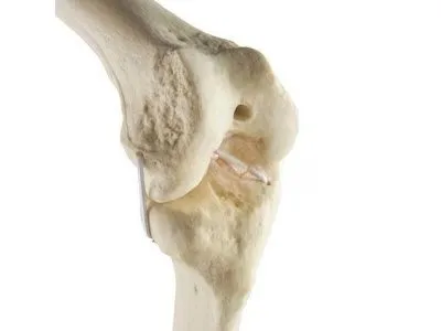 1019622 Колено, стандартное, левое, ORTHOBone