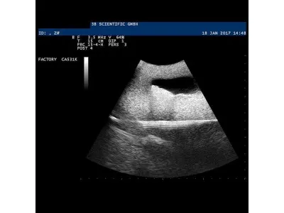 1019637 Модель вен SONOtrain™ для УЗИ