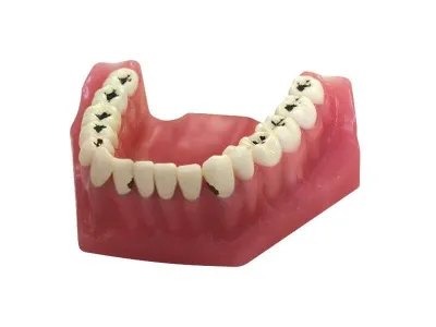 М0360 Денто-модель верхней и нижней челюстей для лечения кариеса ЧВН-32К