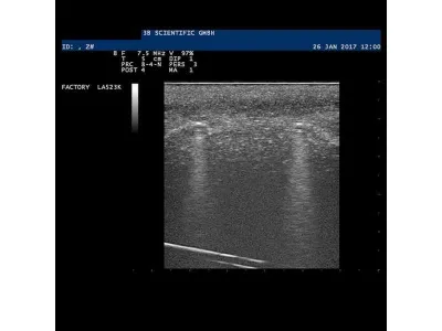 1019636 Модель инородного тела SONOtrain™ для УЗИ