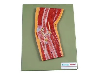 GD/A11203 Модель локтевого сустава в разрезе (на подставке)