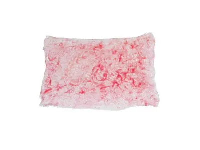 1018424 Ожоги 2-й степени (глубокие)