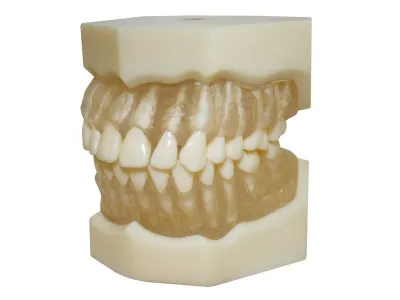 М0402 Денто-модель верхней и нижней челюстей с прозрачными деснами для удаления ЧВН-28УП