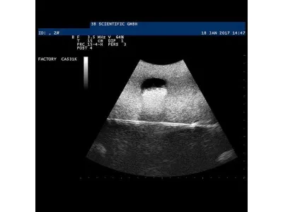 1019637 Модель вен SONOtrain™ для УЗИ