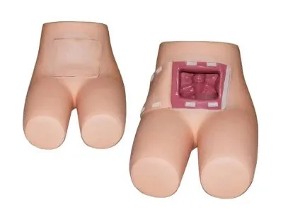 P35 Тренажер ВОЛОДЕФ-1 для отработки навыков проведения клизмы