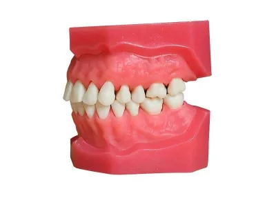 М0267 Денто-модель верхней и нижней челюстей для удаления ЧВН-28У