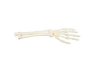 Рука и запястье, ORTHOBone 1018337 Рука и запястье, ORTHOBone