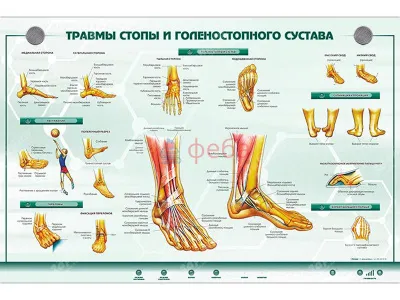 310_Стенд_Травмы_стопы_голеностопного_сустава
