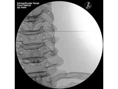 1021900 Тренажер инъекций шейного отдела позвоночника P67