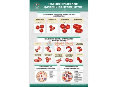 310_МУ0243_Патологические_формы_эритроцитов