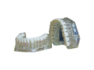 М0249 Денто-модель верхней и нижней челюстей для эндодонтии ЧВН-32Э