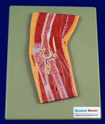 310_A11203_Модель локтевого сустава в разрезе (на подставке)1