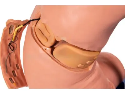 P1046 Манекен-симулятор для отработки навыков пункции грудной клетки с электронным контроллером