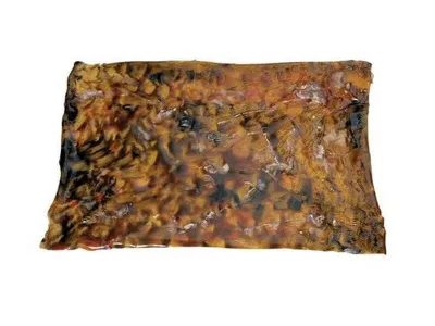 1018425 Ожоги 3-ей степени