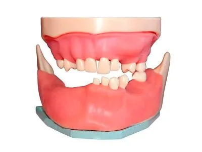 М0363 Денто-модель для хирургической практики