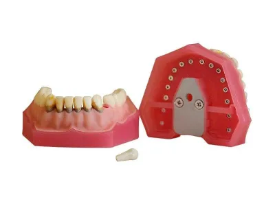 М0361 Денто-модель верхней и нижней челюстей для лечения пародонтоза ЧВН-32П
