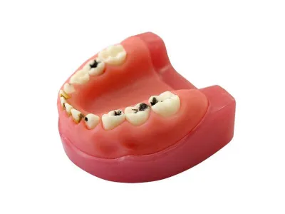 М0253 Денто-модель с патологиями ЧВН-24П