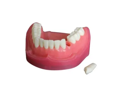 МУ0135 Денто-модель верхней и нижней челюсти ЧВН-28