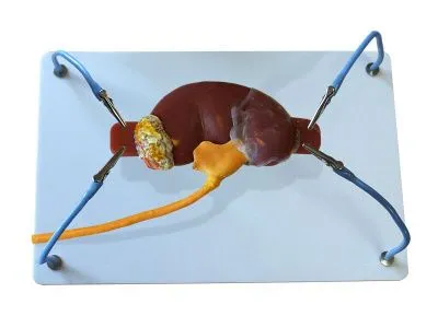 МУ0509 Пособие для отработки навыков лапароскопии «Почка с мочеточником»