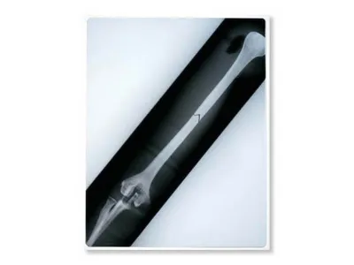 1017988 Тренажер перелома Life/form