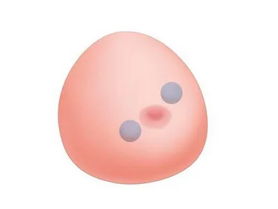 1019634 Модель молочной железы с кистами SONOtrain™ с возможностью УЗИ-обследования