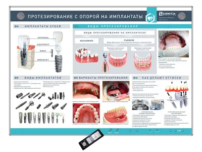 310_МУ0211_Стенд_Протезирование_с_опорой_на_имплантаты