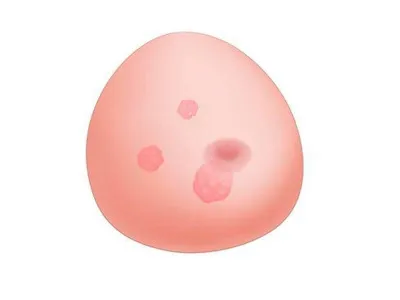 1019635 Модель молочной железы с опухолями SONOtrain™ с возможностью УЗИ-обследования