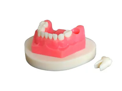 М0204 Денто-модель для экстракции временных зубов ЧВН-20Э