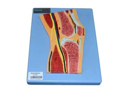 GD/A11206 Модель коленного сустава в разрезе (на подставке)