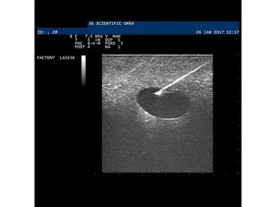 1019634 Модель молочной железы с кистами SONOtrain™ с возможностью УЗИ-обследования