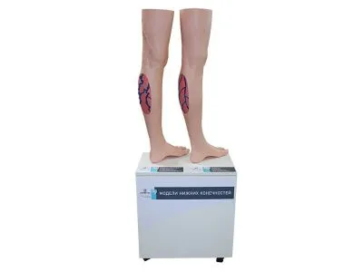 М0548 Модели нижних конечностей взрослого человека, для демонстрации варикозного заболевания вен