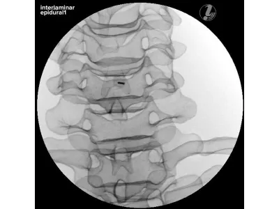 1021900 Тренажер инъекций шейного отдела позвоночника P67